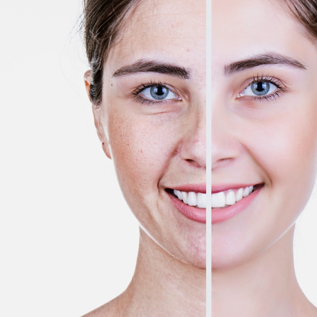 Anti-Aging: How to Keep Your Skin Looking Youthful